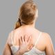 Akne na grudima i leđima: kako ih se rešiti